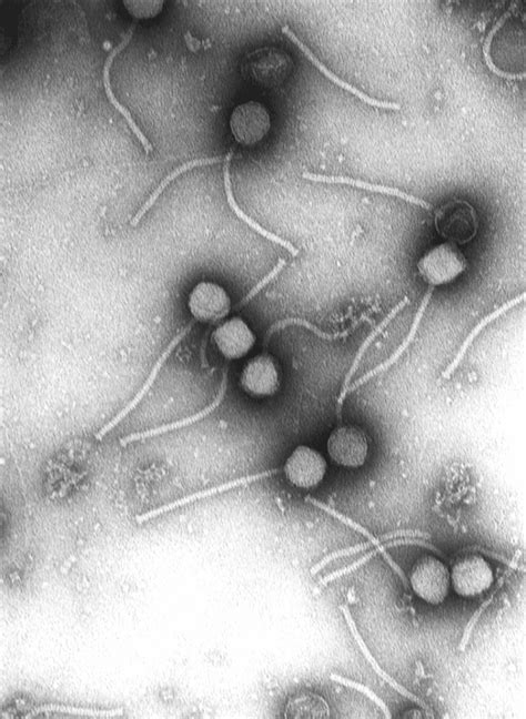 Bacteriophages Viruses In Bacteria And Our Gut Microbiome Owlcation