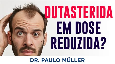 Dutasterida em Dose Baixa É Eficaz Quando Usar Dr Paulo Muller