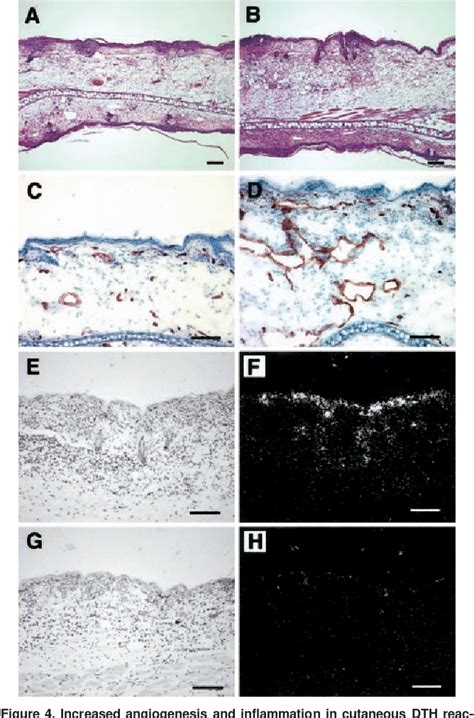 Figure 4 From A Critical Role Of Placental Growth Factor In The