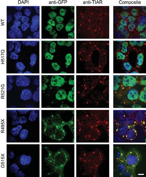 Incorporation Of Mutant Fus Into Stress Granules In Hek Cells Each