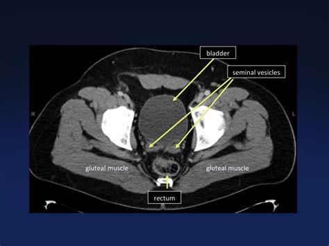 Cross Sectional Anatomy Of The Body Mdct Atlas Ct Scanning