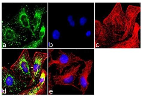 Wnt2b Recombinant Polyclonal Antibody 17hclc Invitrogen™ 100 μg