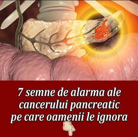 Semne De Alarma Ale Cancerului Pancreatic Pe Care Oamenii Le Ignora