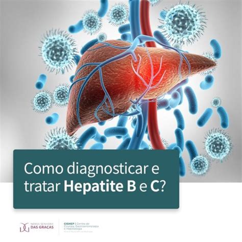 Especialistas Em Hepatite B - Como diagnosticar e tratar Hepatite B e C? - Cighep