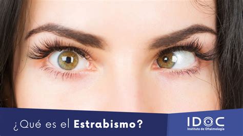 ¿qué Es El Estrabismo Idoc Cirugía Lasik Cataratas Y Carnosidades