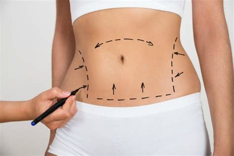 8 Tips For A Fast Recovery After A Tummy Tuck Procedure Beautifi