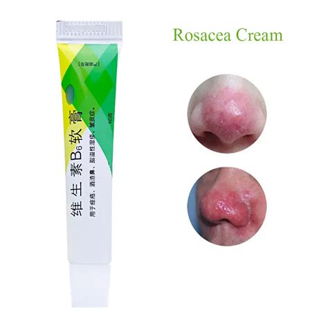 Herbal Medicine Rosacea Cream Treatment Red Nose Acne Mites Rosacea Cream Remove Skin Redness ...