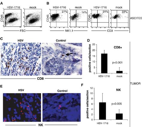 Hsv Promotes Tumor Infiltration Of Cd And Nk Cells A