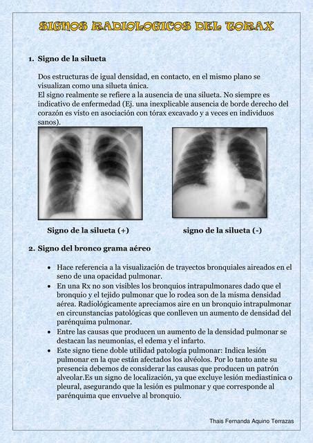 Signos Radiol Gicos Del T Rax Thais Fernanda Aquino Terrazas Udocz