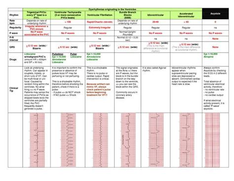 Dysrhythmia Cheat Sheet