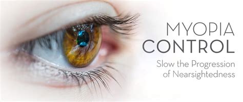 What Is Myopia Control Why It’s Important Mata Clinic And Optometrist Blog