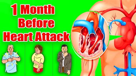 1 Month Before Heart Attack Signs Your Body Gives You A Month Before