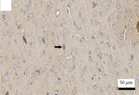 Representative Immunohistochemistry Micrographs Of Cortical Tissues