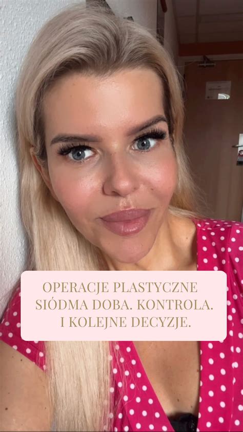 Operacje plastyczne Siódma doba Kontrola Kolejne decyzje Kasia Guzik