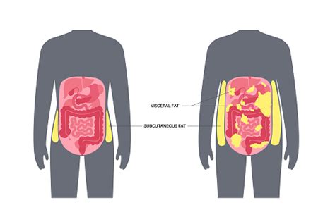 Visceral Fat Diagram Stock Illustration Download Image Now The