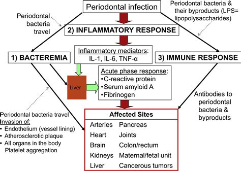 Does Treatment Of Periodontal Disease Influence Systemic Disease Dental Clinics