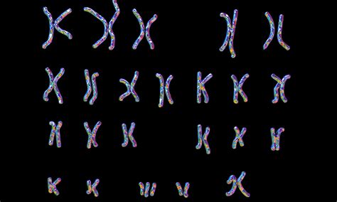 Genetics behind skull changes in Down Syndrome mouse model 