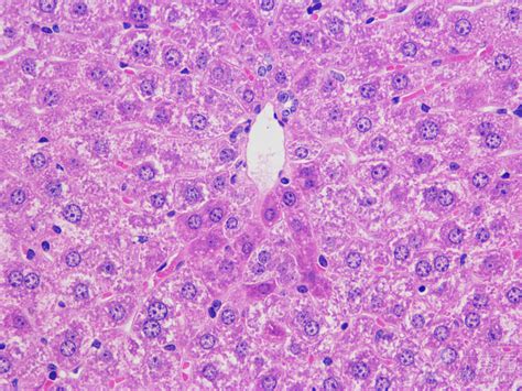 求助小鼠肝脏HE染色切片分析 丁香实验