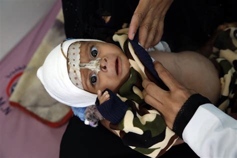 Yemen Remains Worst Humanitarian Crisis Un Office