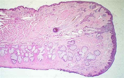 Eyelid Histology