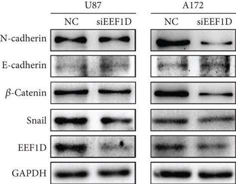 Downregulation Of Eef D Could Regulate The Expression Of Emt Markers