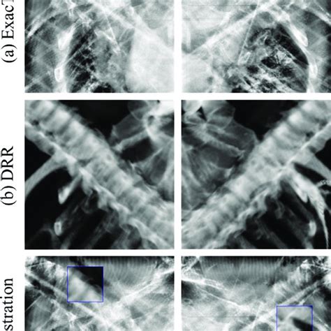 Image Registration Using Varian Cone Beam Computed Tomography CBCT