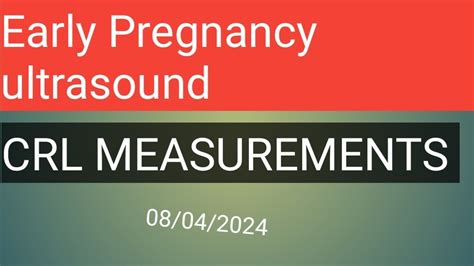 Early Pregnancy Ultrasound ULTRASOUND SHOWING CRL MEASUREMENTS