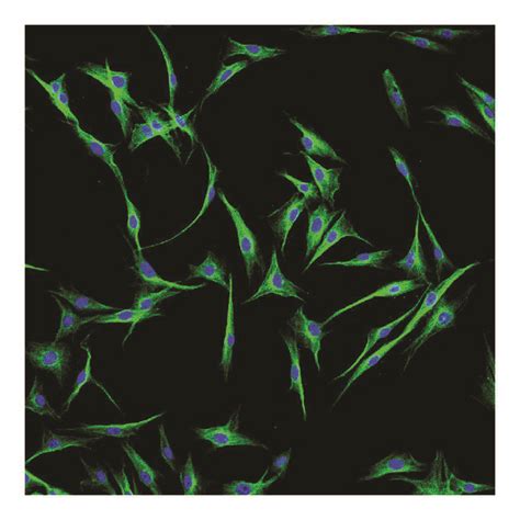 Culture and identification of fibroblast-like synovial cells. After ...