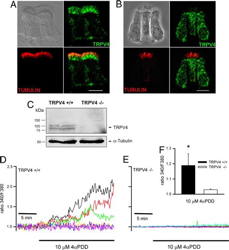 TRPV4 Channel Participates In Receptor Operated Calcium Entry And