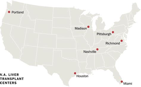 Where You Live Matters For Lifesaving Liver Transplants The New York