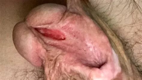 Dicke Zuckende Klitoris Free HD Videos Porn XHamster