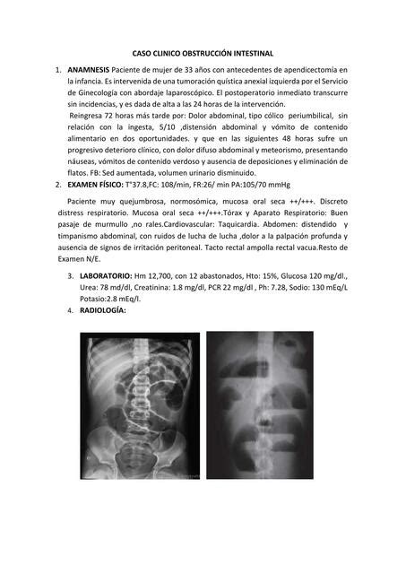 Caso Clinico ObstrucciÓn Intestinal Ciencias De La Salud Udocz