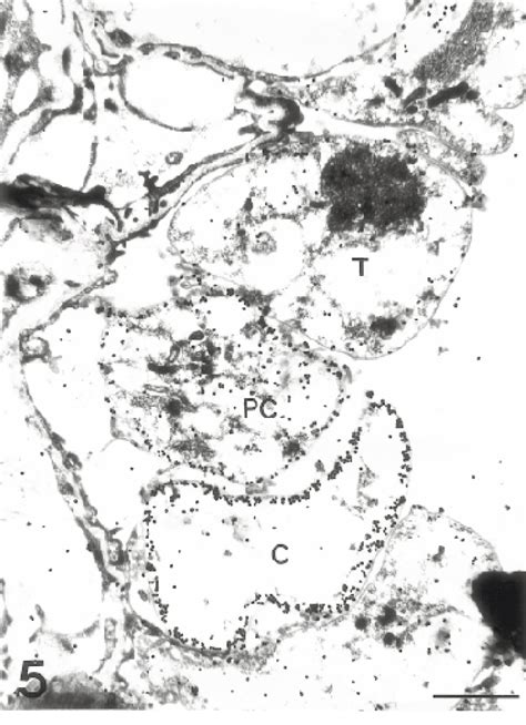 Figure 5 From Localization Of Cytoskeletal Proteins In Pneumocystis Carinii By Immuno Electron