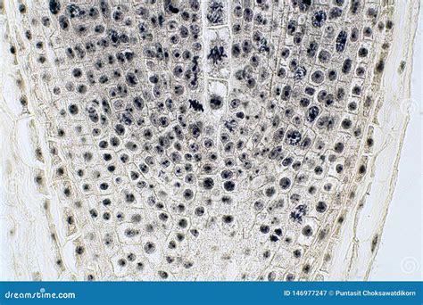 Root Tip of Onion and Mitosis Cell in the Root Tip Stock Image - Image of mitotic, membrane ...