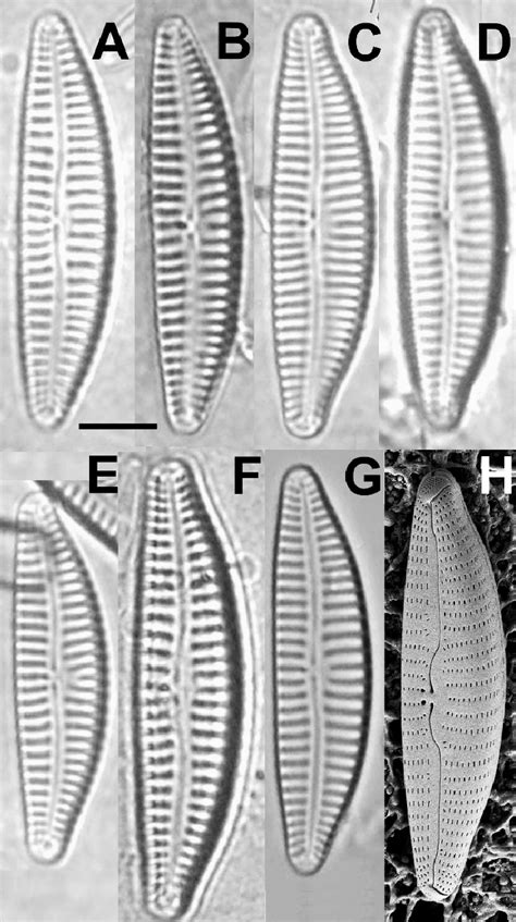 Light and scanning electron microscope micrographs of representative ... 