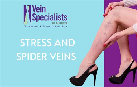 Can Stress Cause Spider Veins On Legs Vein Specialists Of Augusta