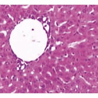 The Pathological Changes Of Liver Tissues In Model Groups A H B