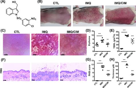 Cim Attenuates Imq Induced Mouse Psoriatic Lesion A The Chemical