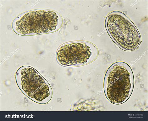 Hookworms In Stool