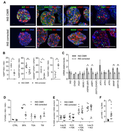 Figures And Data In Insulin Mutations Impair Beta Cell Development In A