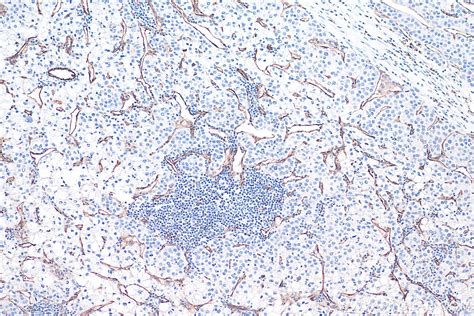 Ihceasy Cd31 Ready To Use Ihc Kit Khc0022 Proteintech