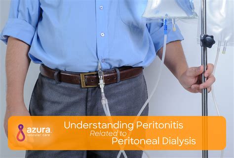 Peritonitis Related to Peritoneal Dialysis | What are the Causes?