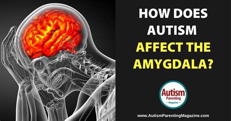 How Does Autism Affect the Amygdala? - Autism Parenting Magazine