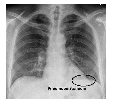 Imaging Case Of The Week 246 Answer Emergucate