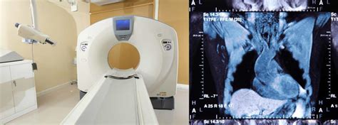 Medical X Ray Imaging Using Computed Tomography Open Medscience