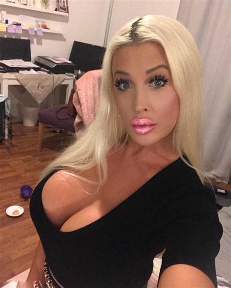 Sindy Starlet Now Has The Biggest Boobs In Norway 16 Pics