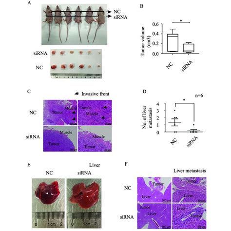 Hsa Circ 0006401 Promoted The Proliferation And Migration Of CRC Cells