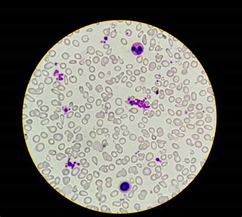 Human White Blood Cells Under Microscope