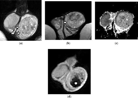 Figure 1 From An Overview Of The Role Of Multiparametric Mri In The