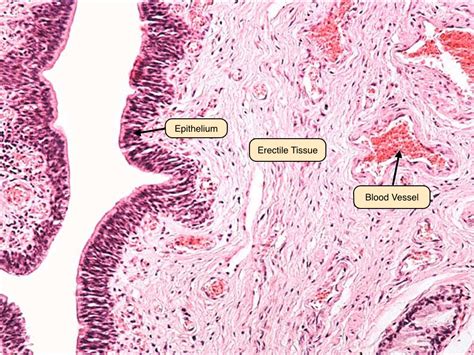 Seminal Vesicle